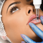 LIP MICROPIGMENTATION