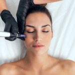 MICRONEEDLING DERMAPEN